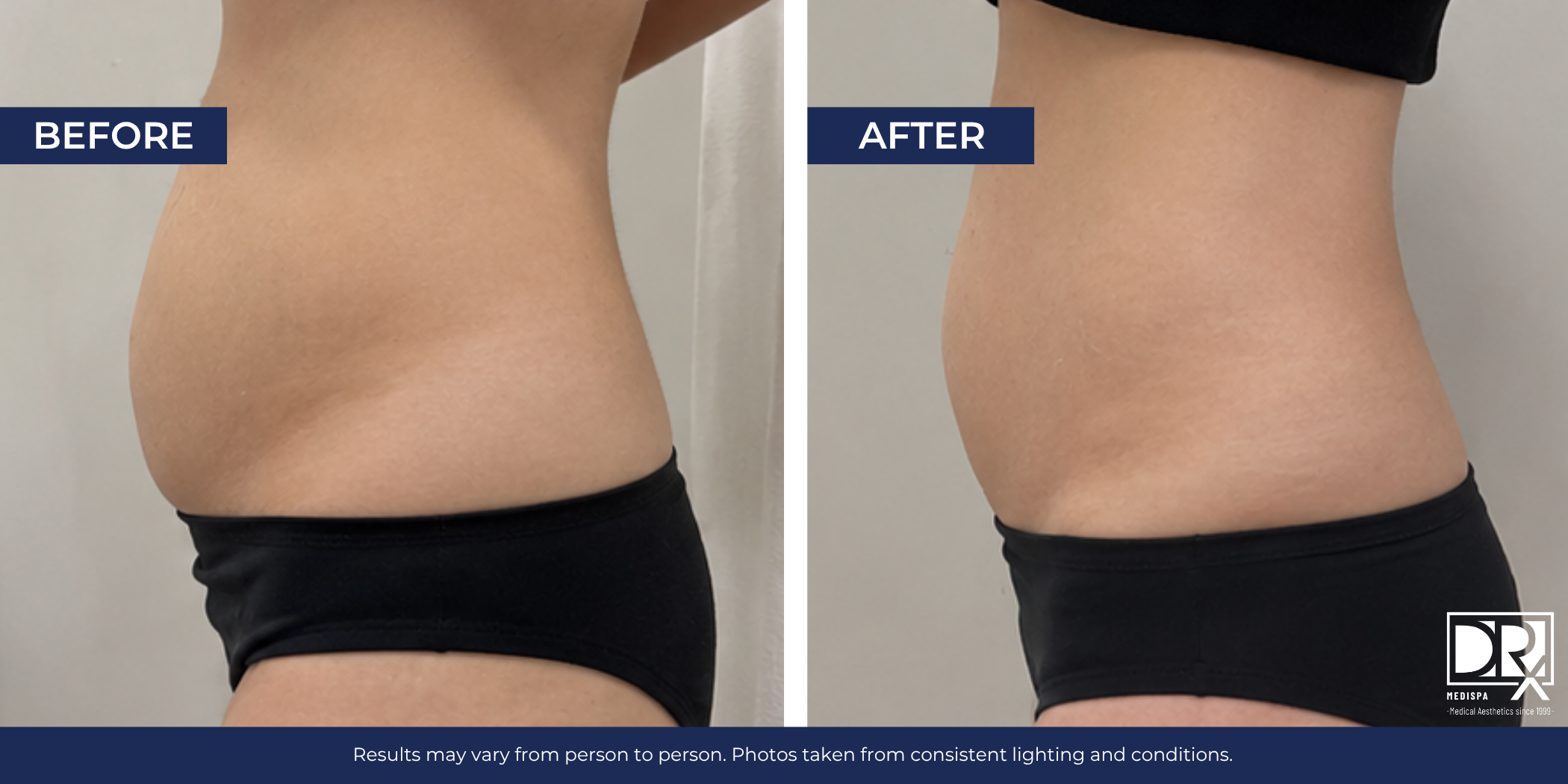 Belly Pouch