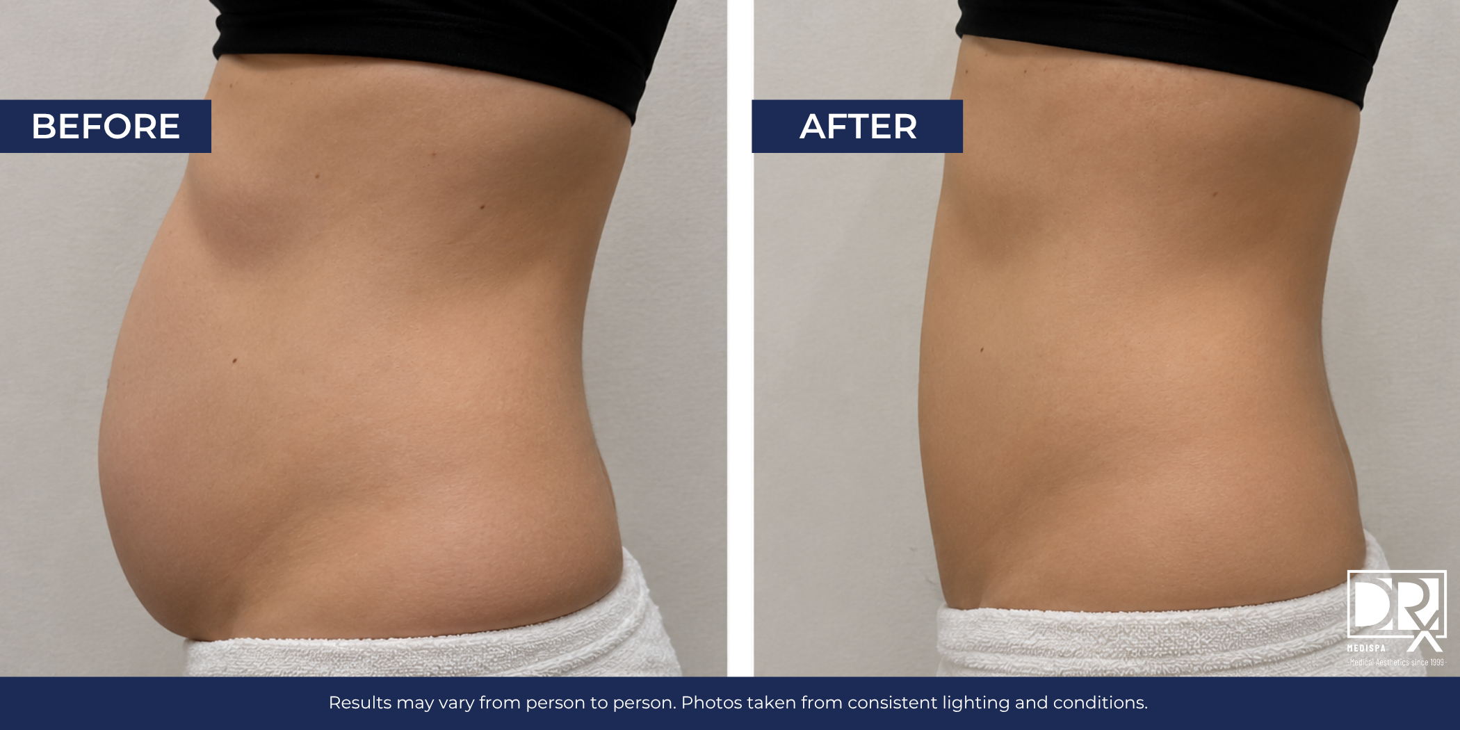 Lower Abdominal